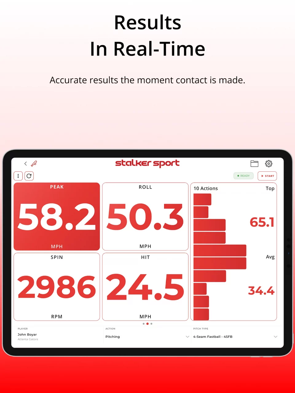 Stalker Sport Radar