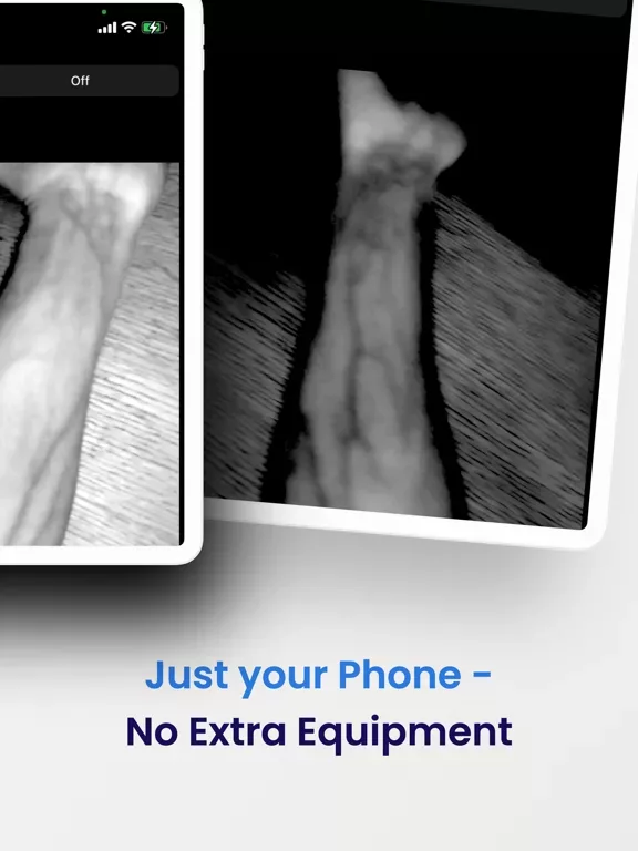 VeinSeek Pro