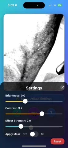 VeinScout