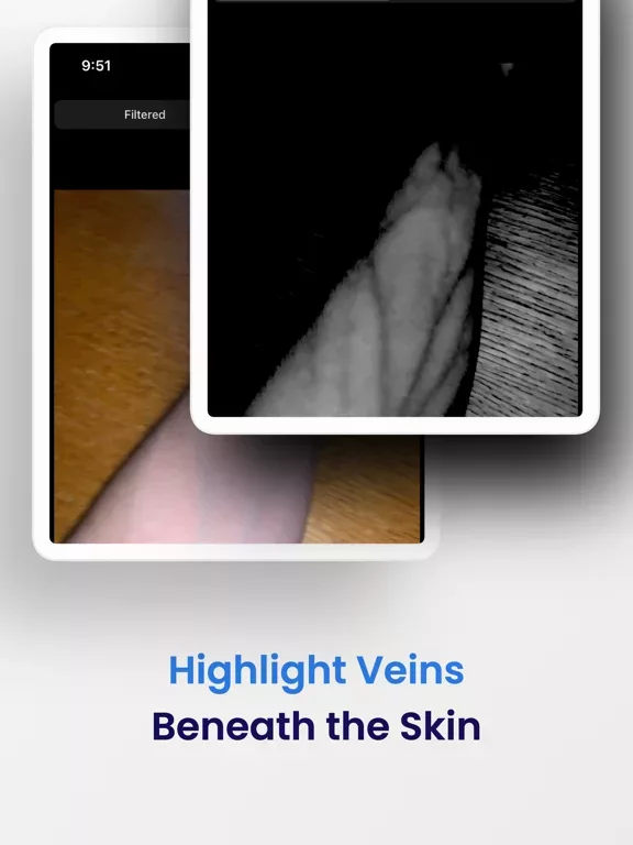 VeinSeek Pro