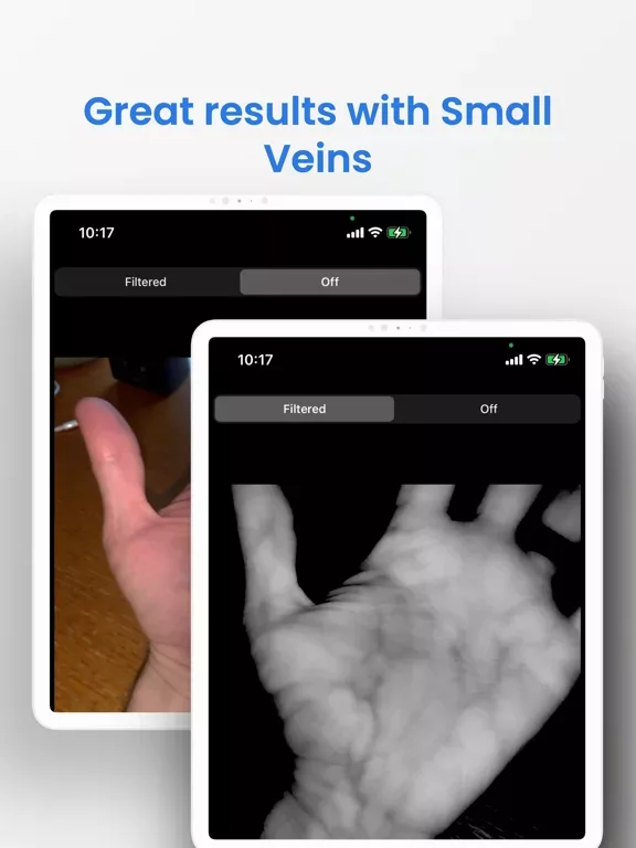 VeinSeek Pro
