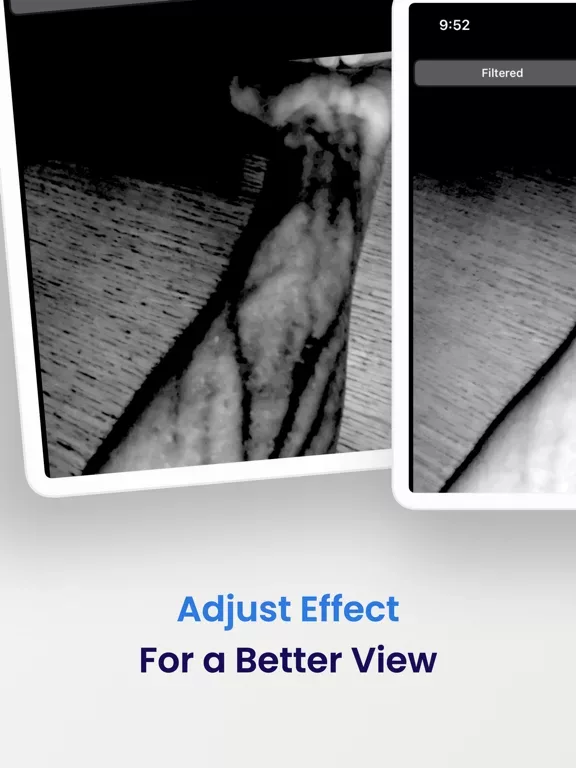 VeinSeek Pro