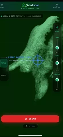 VeinRadar