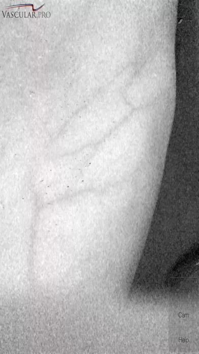 Vein Camera
