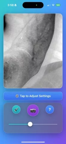 VeinScout