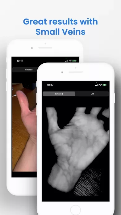 VeinSeek Pro